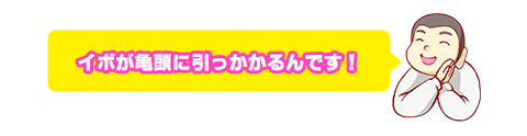 イボが亀頭に引っかかる